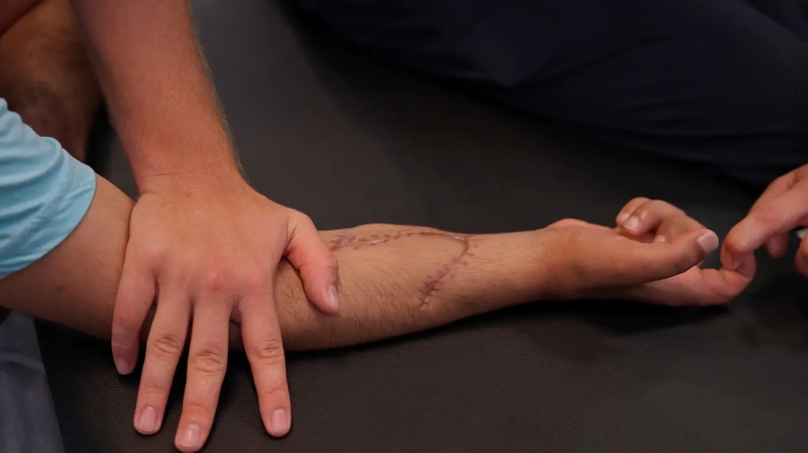 Ortopedik Rehabilitasyon
